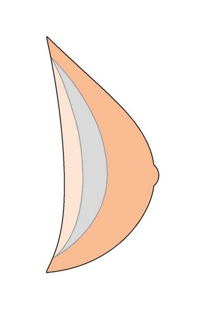 Natura Light 3S Breast Form Size 12 V44401